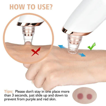 Premium Derma Suction Facial Cleanser - Blackhead Remover